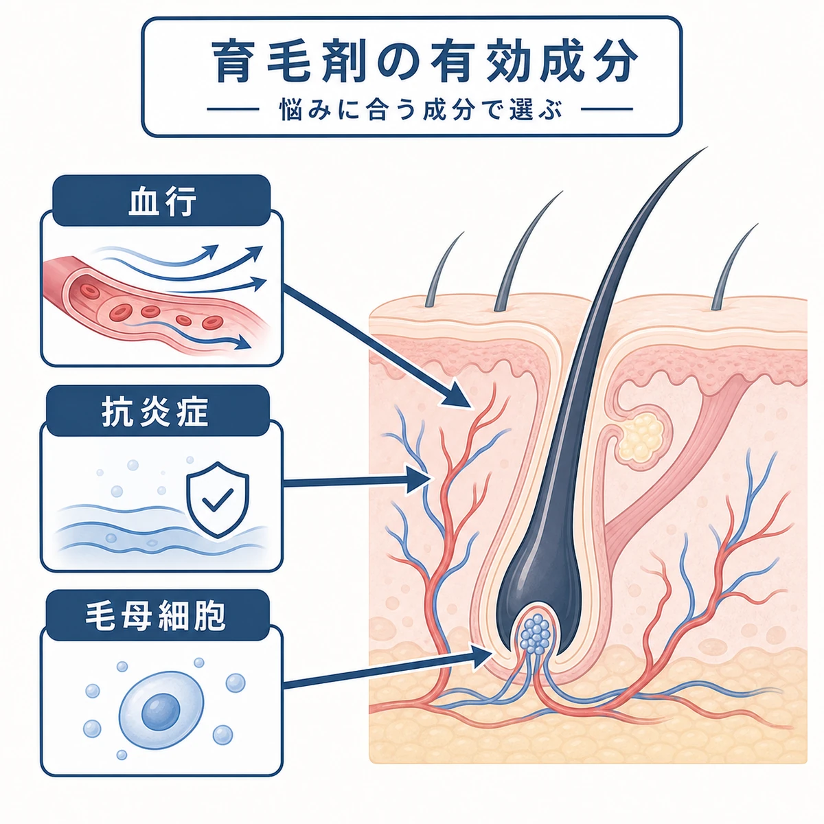 血行促進と抗炎症と毛母細胞への働きという育毛剤の有効成分を毛根断面で表した医療イラスト