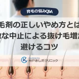 育毛剤の正しいやめ方とは？急激な中止による抜け毛増加を避けるコツ