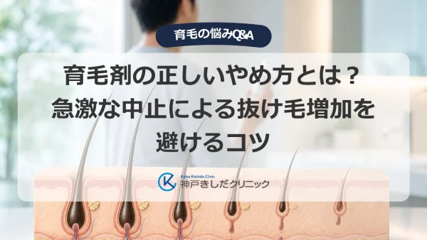 育毛剤の正しいやめ方とは？急激な中止による抜け毛増加を避けるコツ