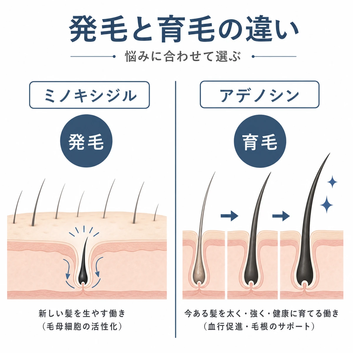ミノキシジルの発毛とアデノシンの育毛という役割の違いを対比した医療イラスト