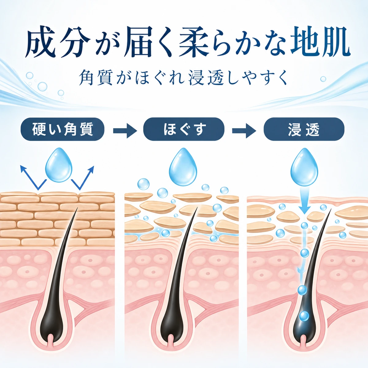 硬い角質がほぐれて育毛成分が毛根まで届くまでの流れを表した医療イラスト