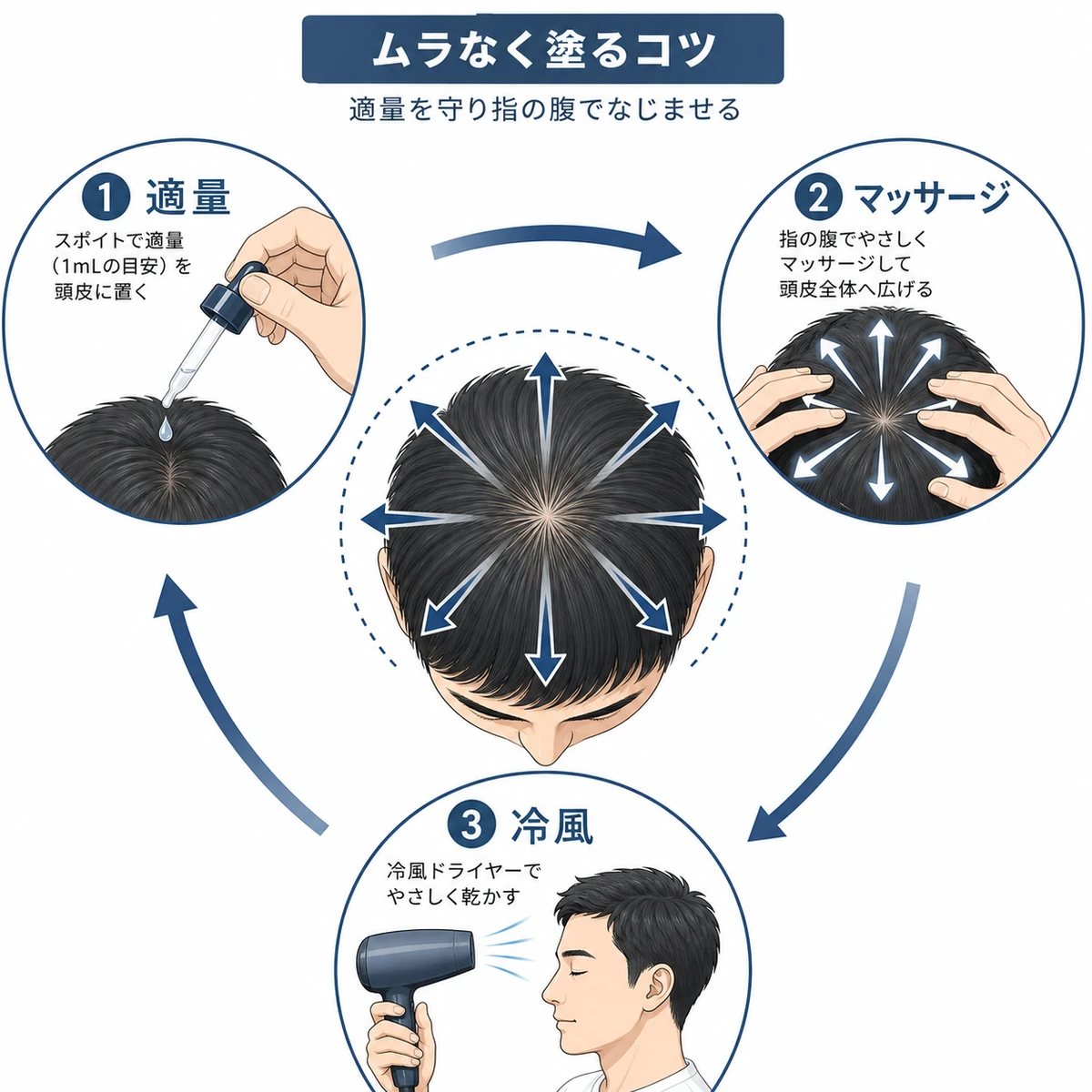 育毛剤を適量なじませ指の腹でマッサージする正しい塗布手順を表した医療イラスト