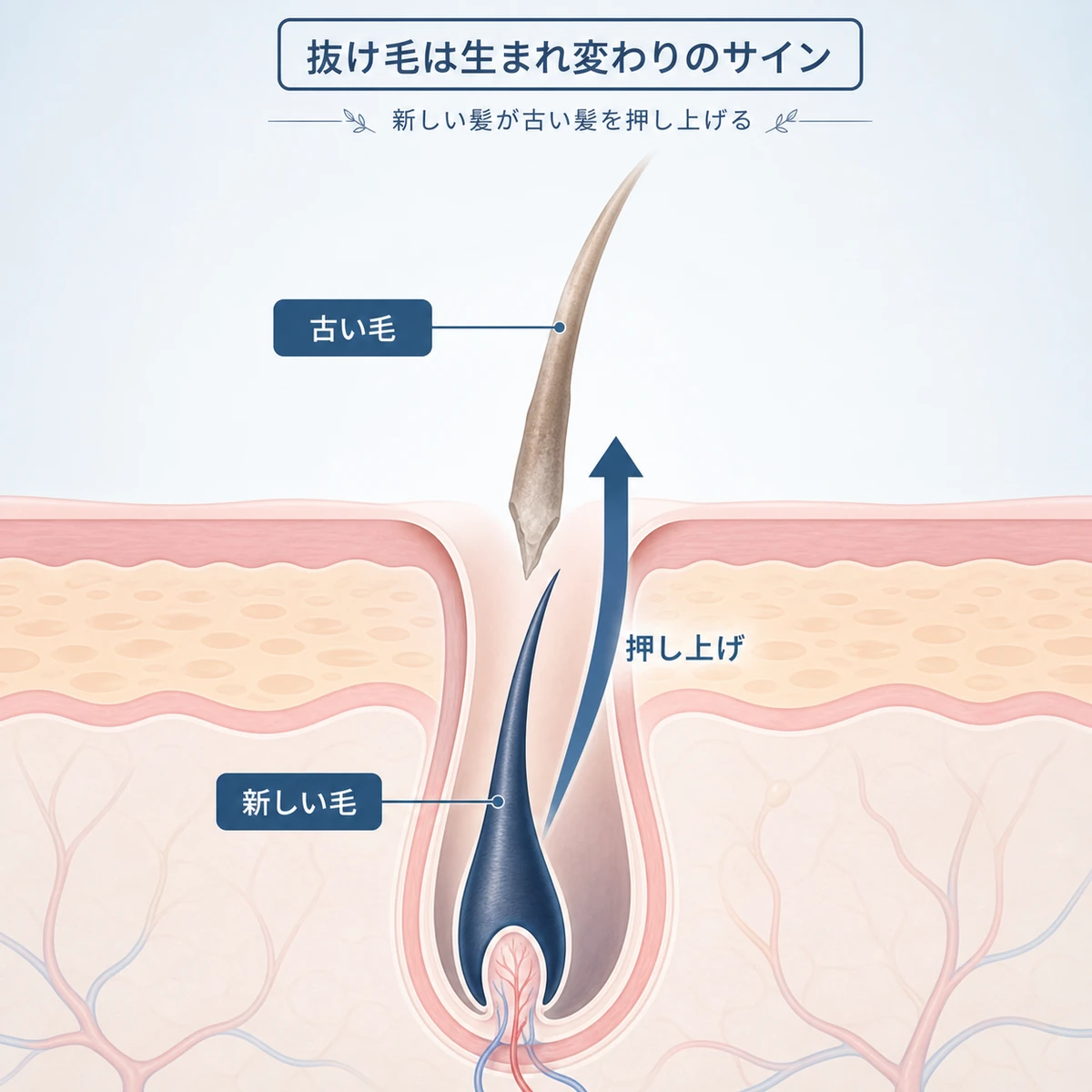毛穴の中で新しい髪が古い髪を下から押し上げるしくみを表した医療イラスト