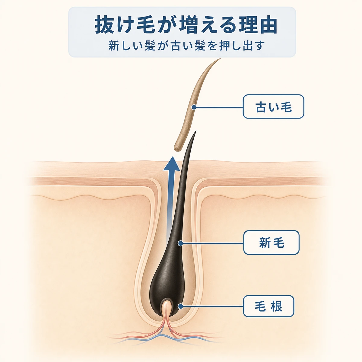 毛穴の奥で新しい髪が古い髪を下から押し上げて生え変わるしくみを表した医療イラスト