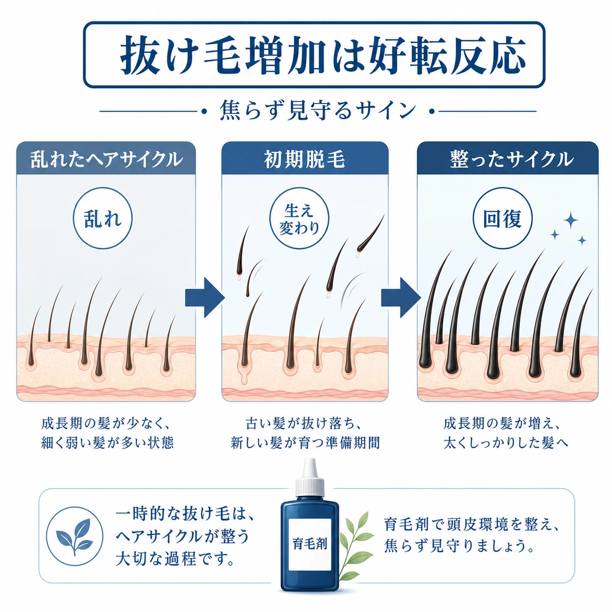 育毛剤の初期脱毛が好転反応として回復へ向かう流れを表した医療イラスト
