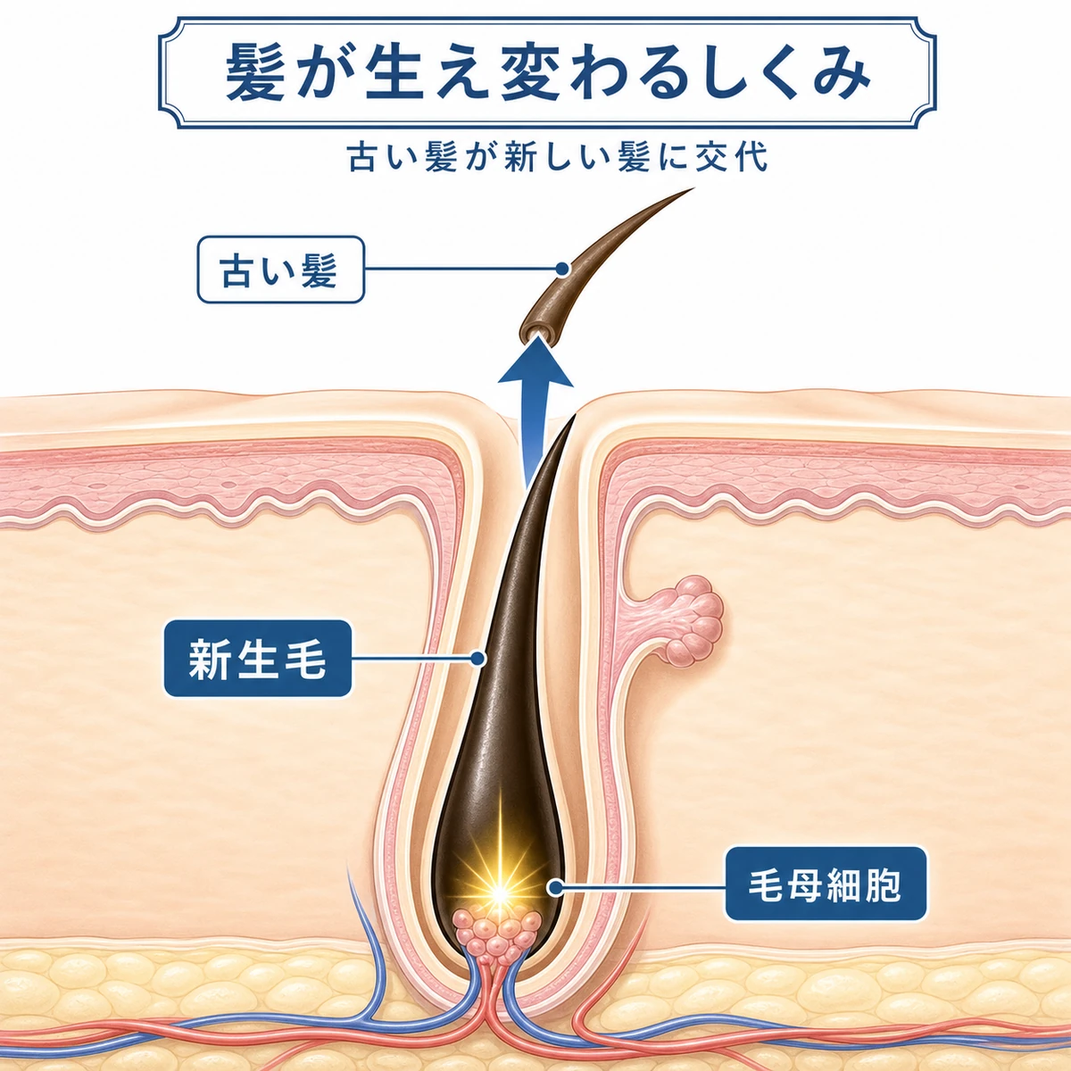 新生毛が下から古い髪を押し上げて生え変わる初期脱毛のしくみを表した医療イラスト
