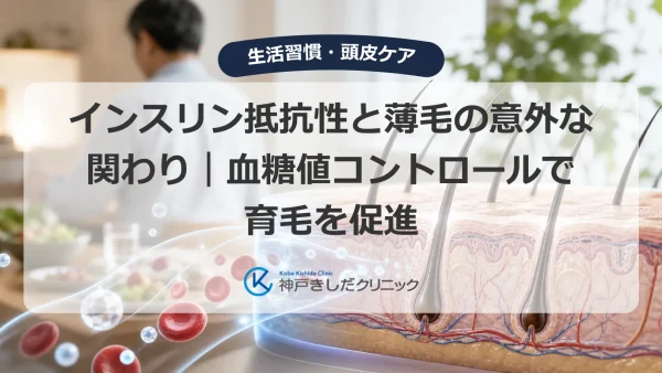インスリン抵抗性と薄毛の意外な関わり｜血糖値コントロールで育毛を促進