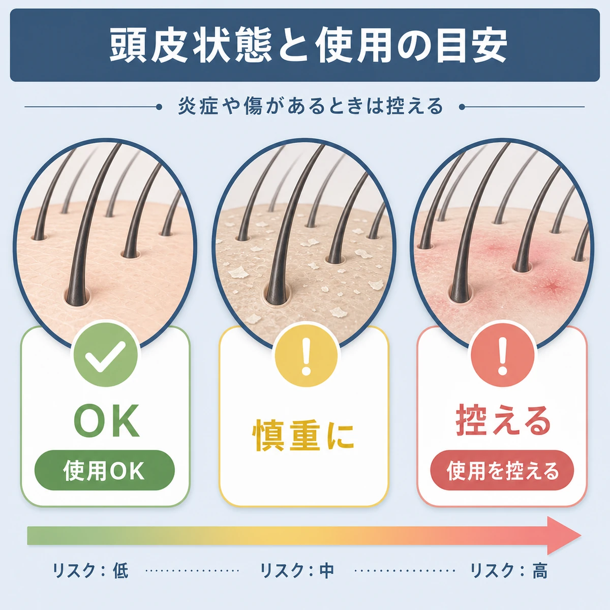 健康・乾燥・炎症の頭皮状態ごとに使用の可否を穏やかに表した医療イラスト