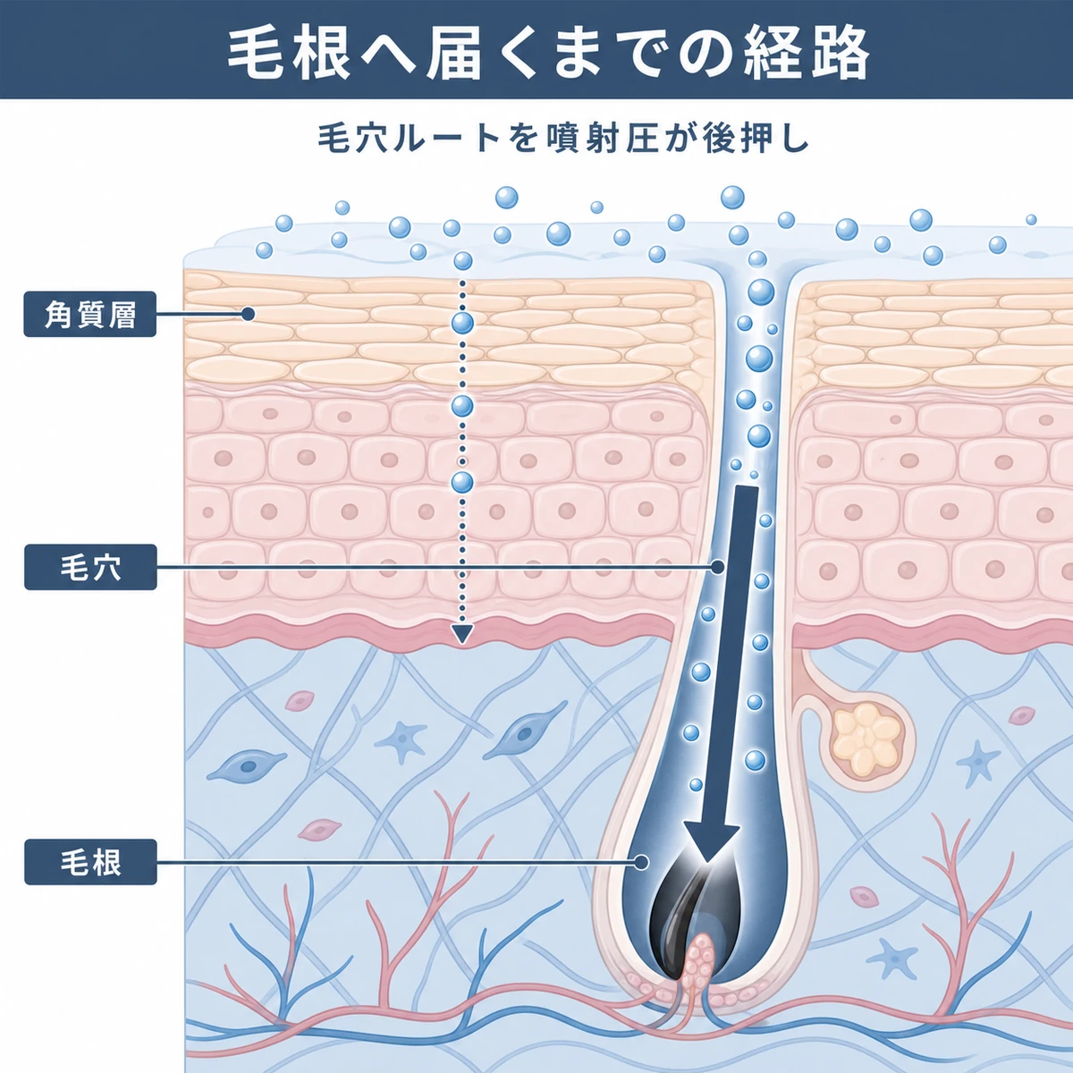 頭皮の層構造を毛穴ルートに沿って有効成分が毛根へ届く経路を表した医療イラスト