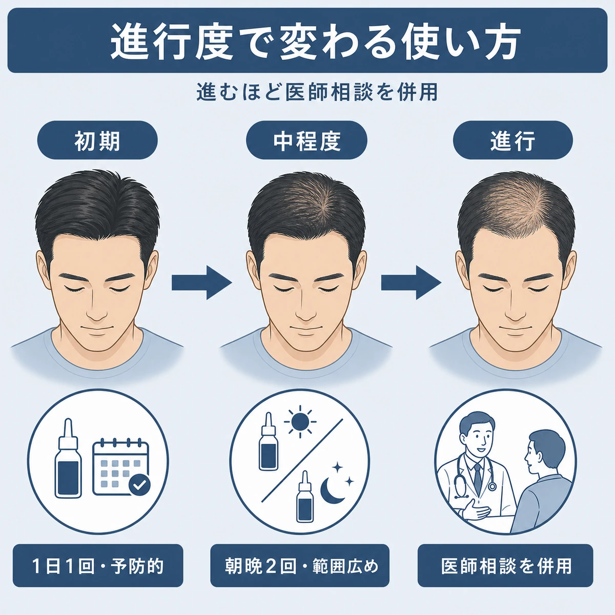 薄毛の進行度が初期から進行へ進むほど使い方と医師相談の併用が変わることを表した医療イラスト