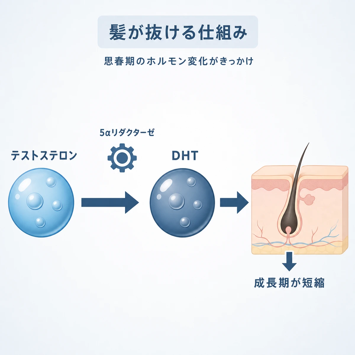 思春期のホルモンがDHTに変わり毛根の成長期が短くなる仕組みを表した医療イラスト