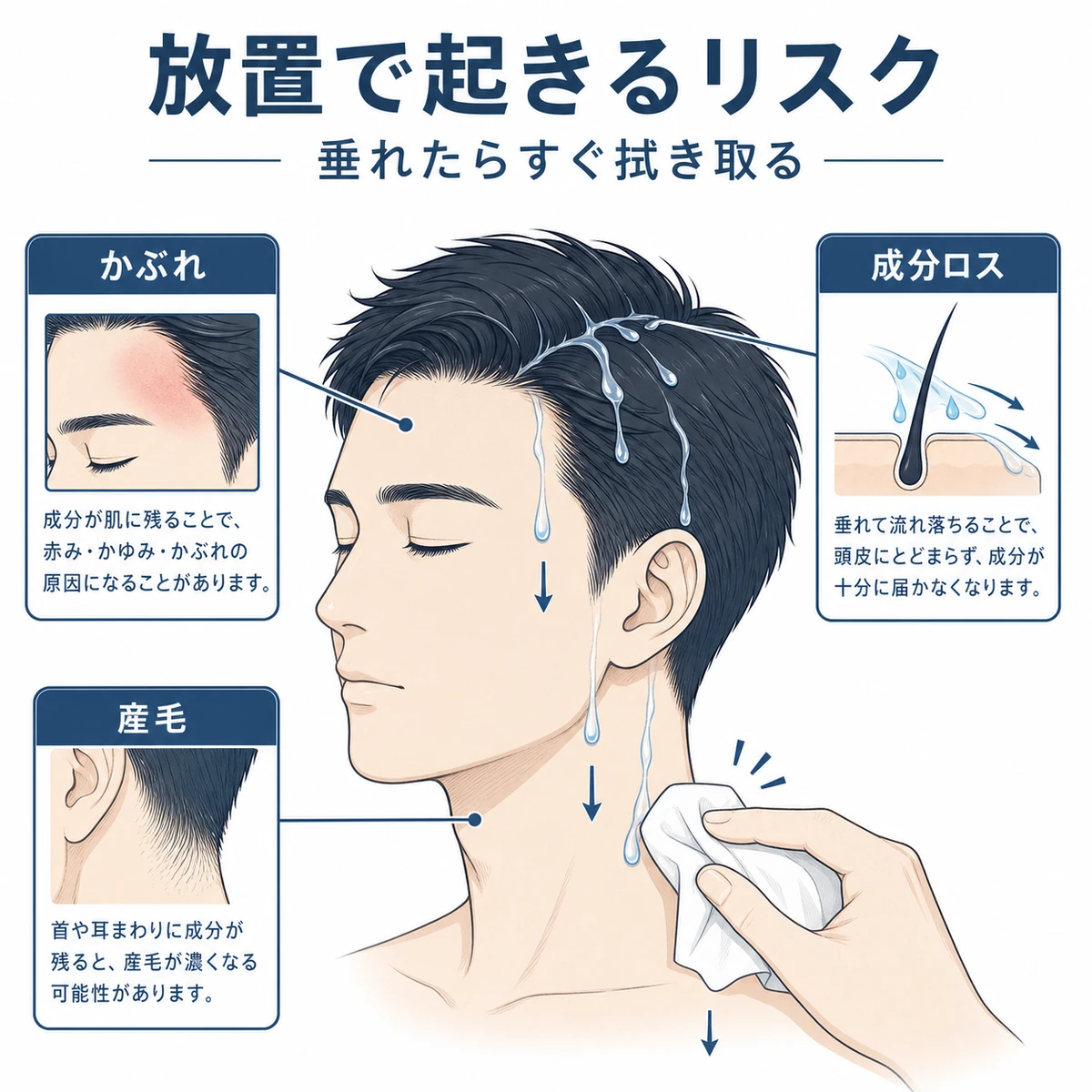 額のかぶれや成分ロスなど育毛剤の液垂れを放置したときのリスクを表した医療イラスト