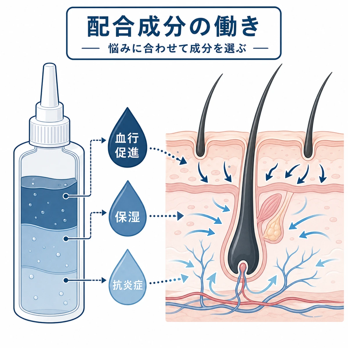 安い育毛剤に含まれる血行促進や保湿の成分が頭皮に届く働きを表した医療イラスト