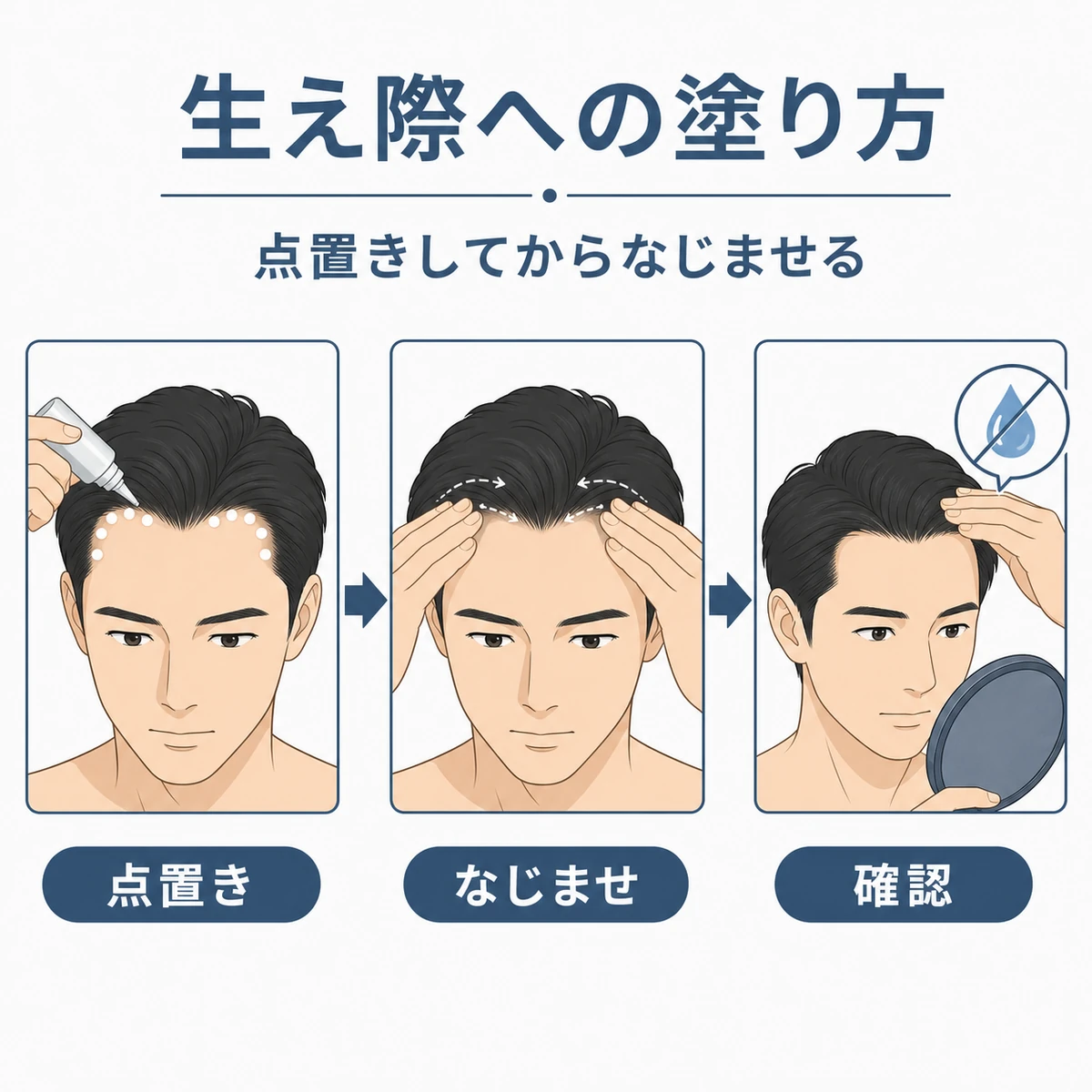 成人男性の生え際への育毛剤の塗り方を三段階の流れで描いた医療イラスト