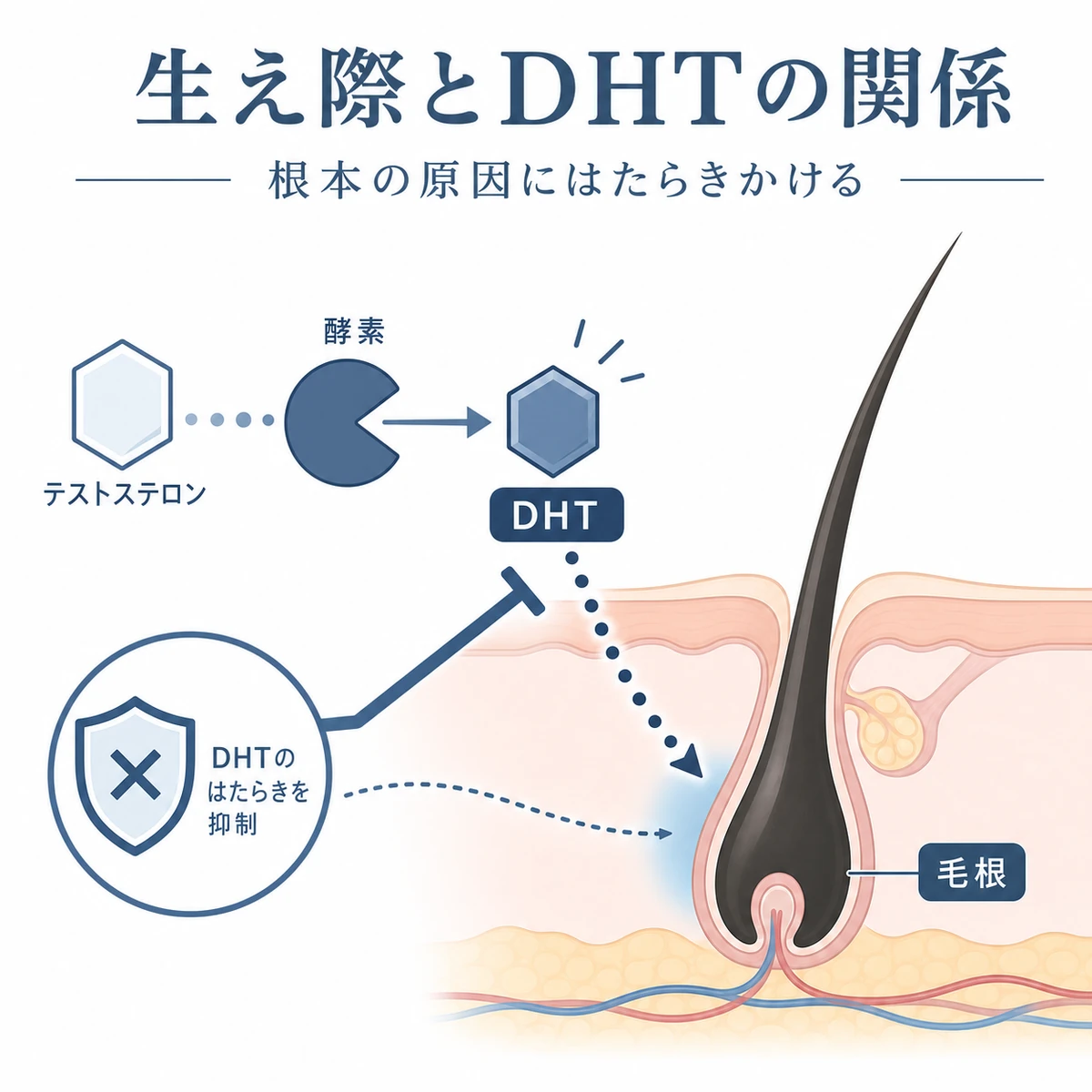 前頭部の生え際に集まるDHTをAGA薬が抑えるしくみを表した頭部側面の医療イラスト