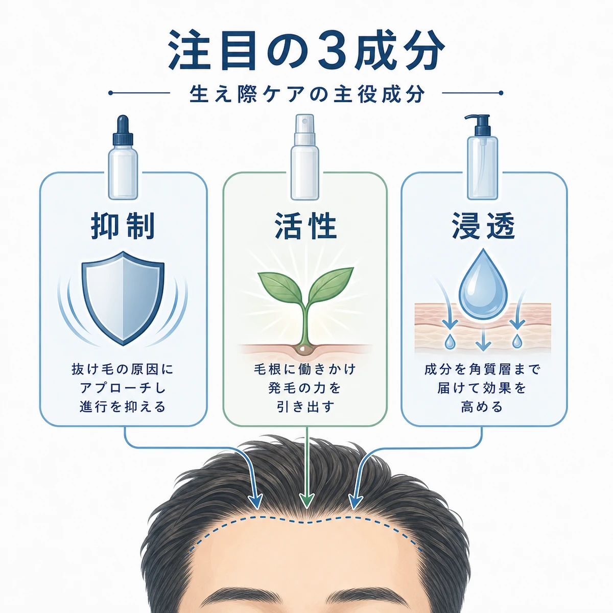 キャピキシルやリデンシルなど生え際ケアで注目される成分の役割の違いを表した医療イラスト