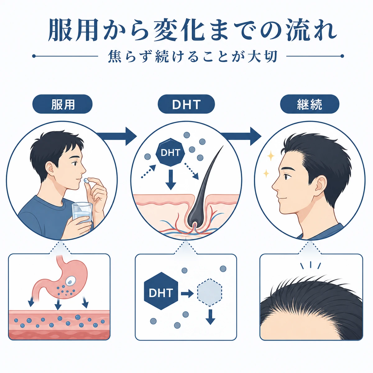 服用開始から変化を感じるまでの期間の流れを示した医療イラスト