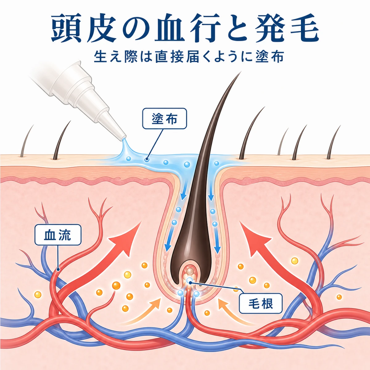外用薬で頭皮の血行が促され毛根が元気になる様子を表した医療イラスト