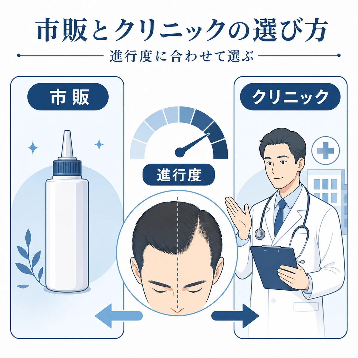 市販の育毛剤とクリニック処方の使い分けを進行度で比べた医療イラスト