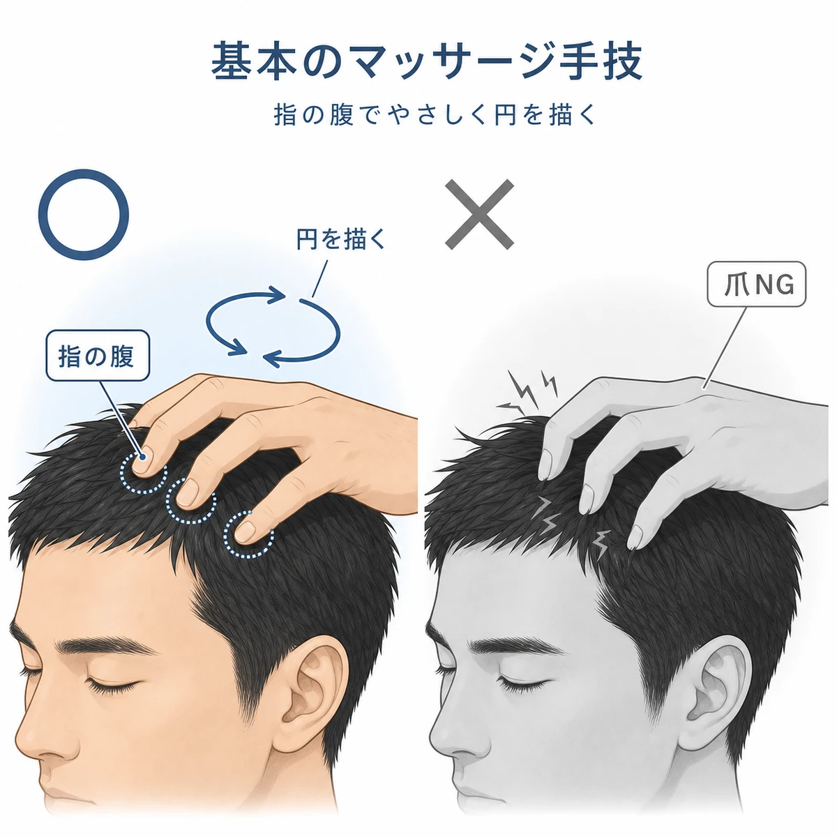 指の腹で円を描く正しい頭皮マッサージと爪を立てる誤った例を対比した医療イラスト