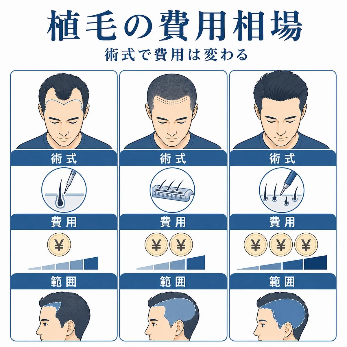 植毛のFUE法とFUT法の費用感の違いを左右で対比した医療イラスト