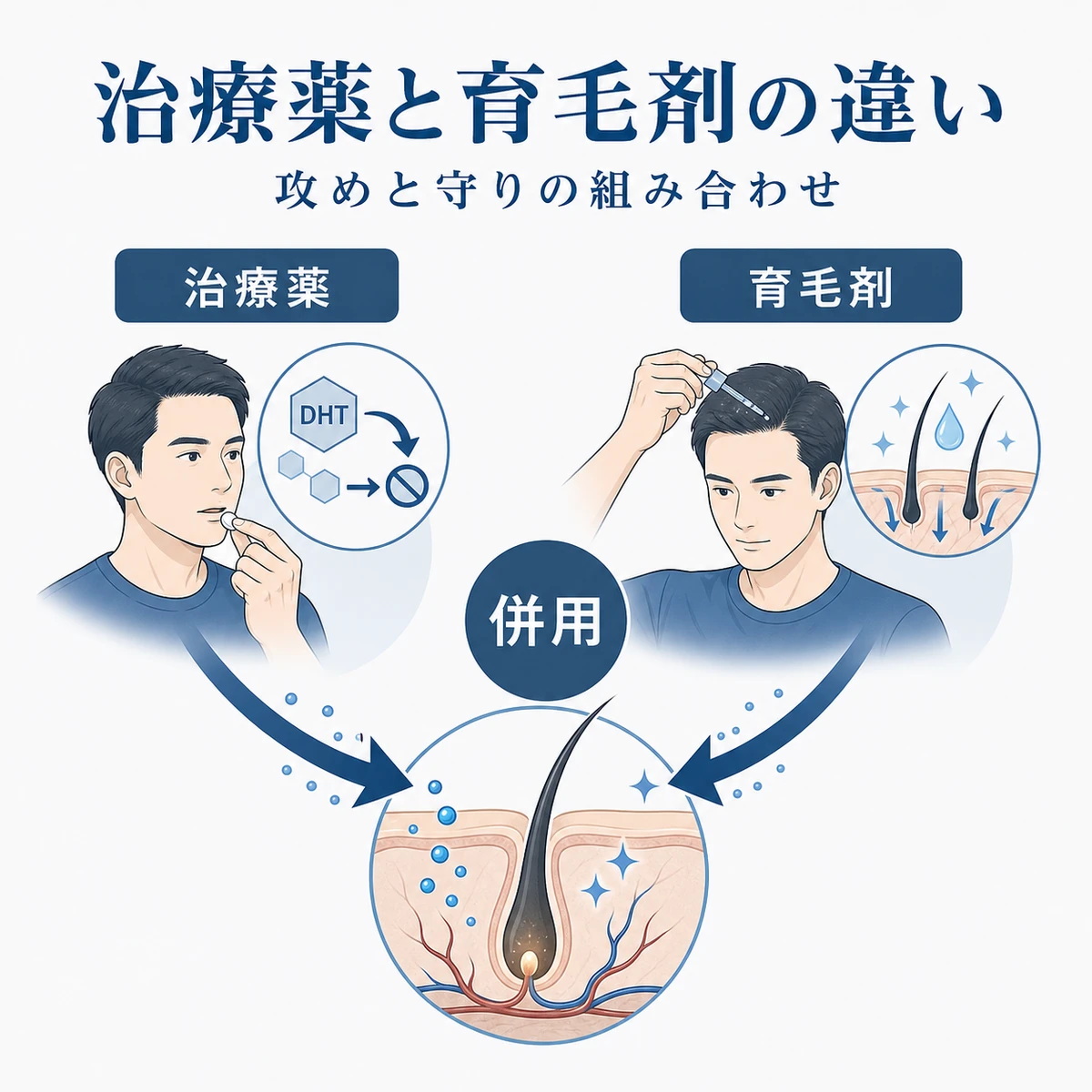 AGA治療薬と育毛剤の役割の違いと組み合わせによる相乗効果を表した医療イラスト