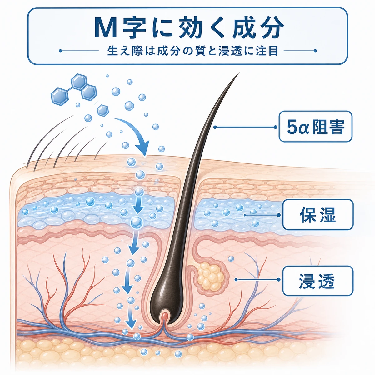 生え際の断面で成分が毛根へ浸透するM字対策の仕組みを表した医療イラスト
