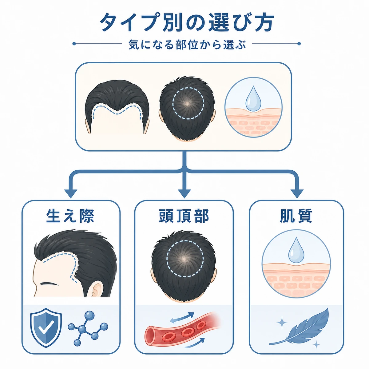 気になる部位から成分を選び分ける育毛剤の判断フローを示した医療イラスト