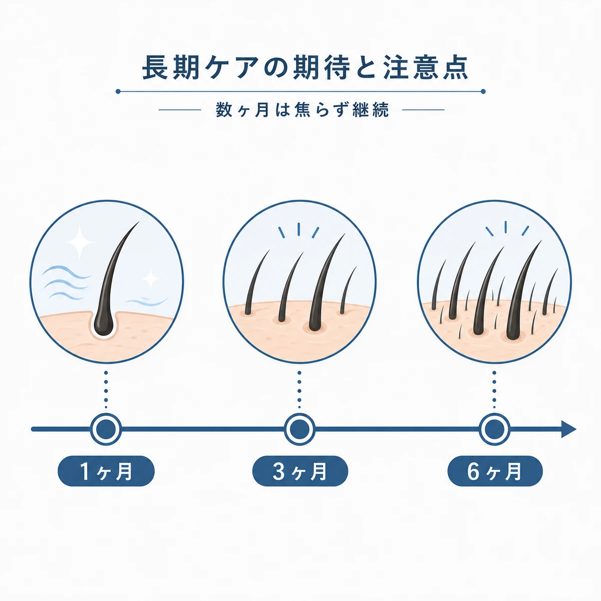 月ごとに変化が現れる育毛剤の長期的な経過を時間軸で表した医療イラスト