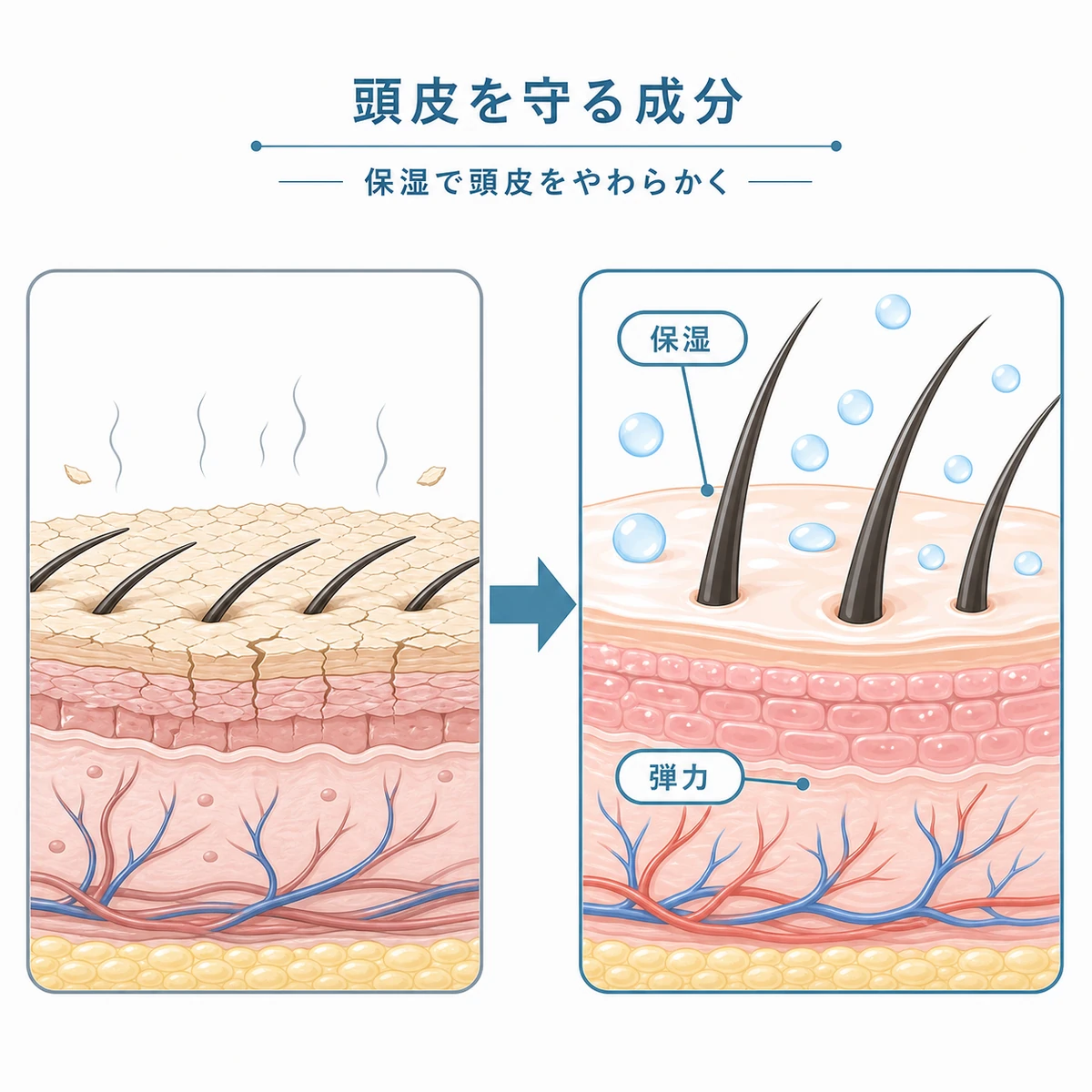 乾いた頭皮と保湿された頭皮の違いを左右で比べた男性向け医療イラスト
