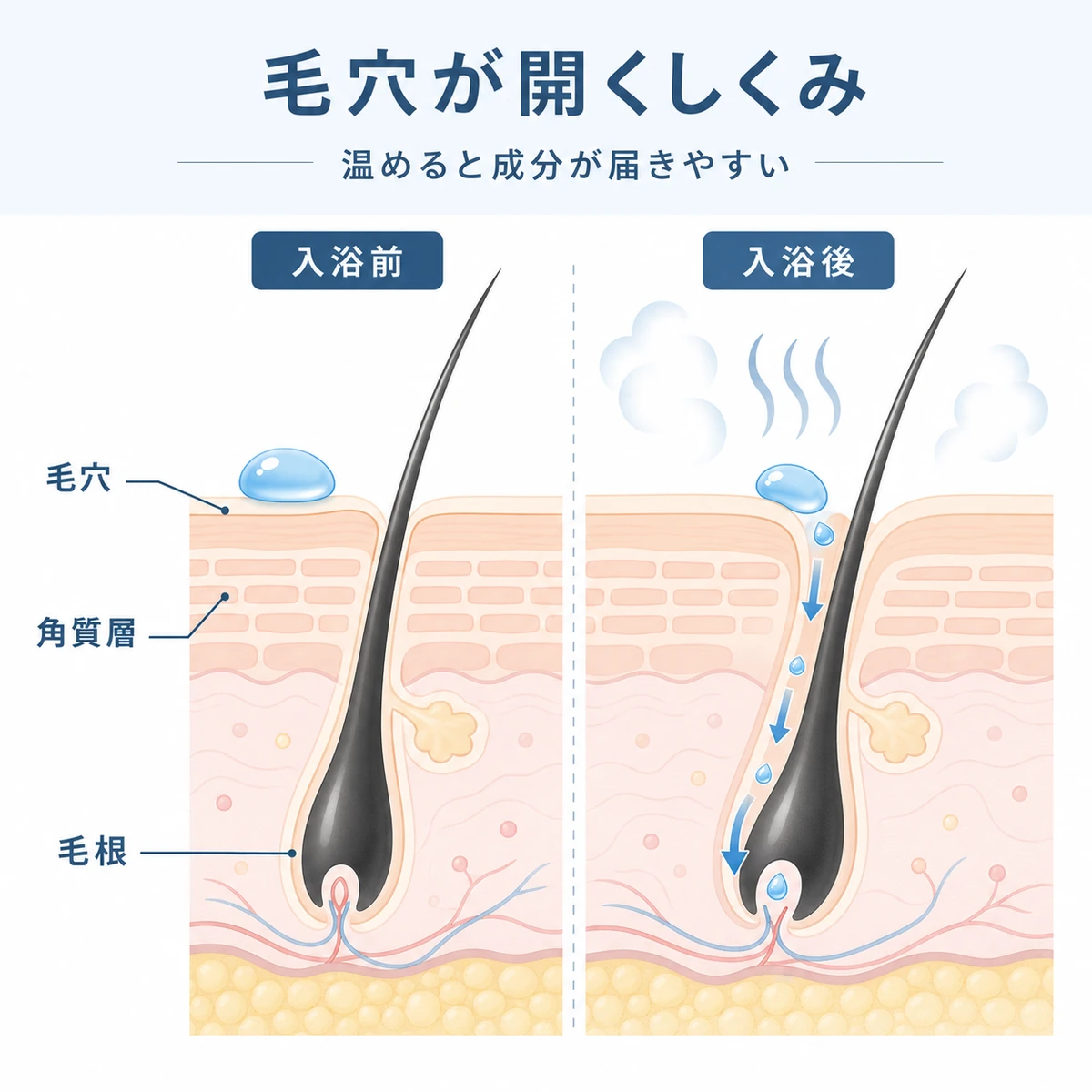 入浴前後で頭皮の毛穴が開き育毛成分が浸透しやすくなる仕組みを表した断面イラスト