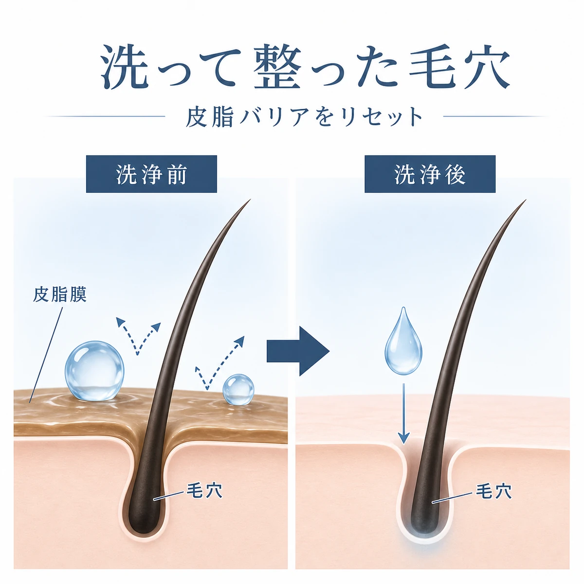シャンプーで酸化皮脂を落とすと毛穴に育毛剤が届きやすくなる前後の対比を表した医療イラスト
