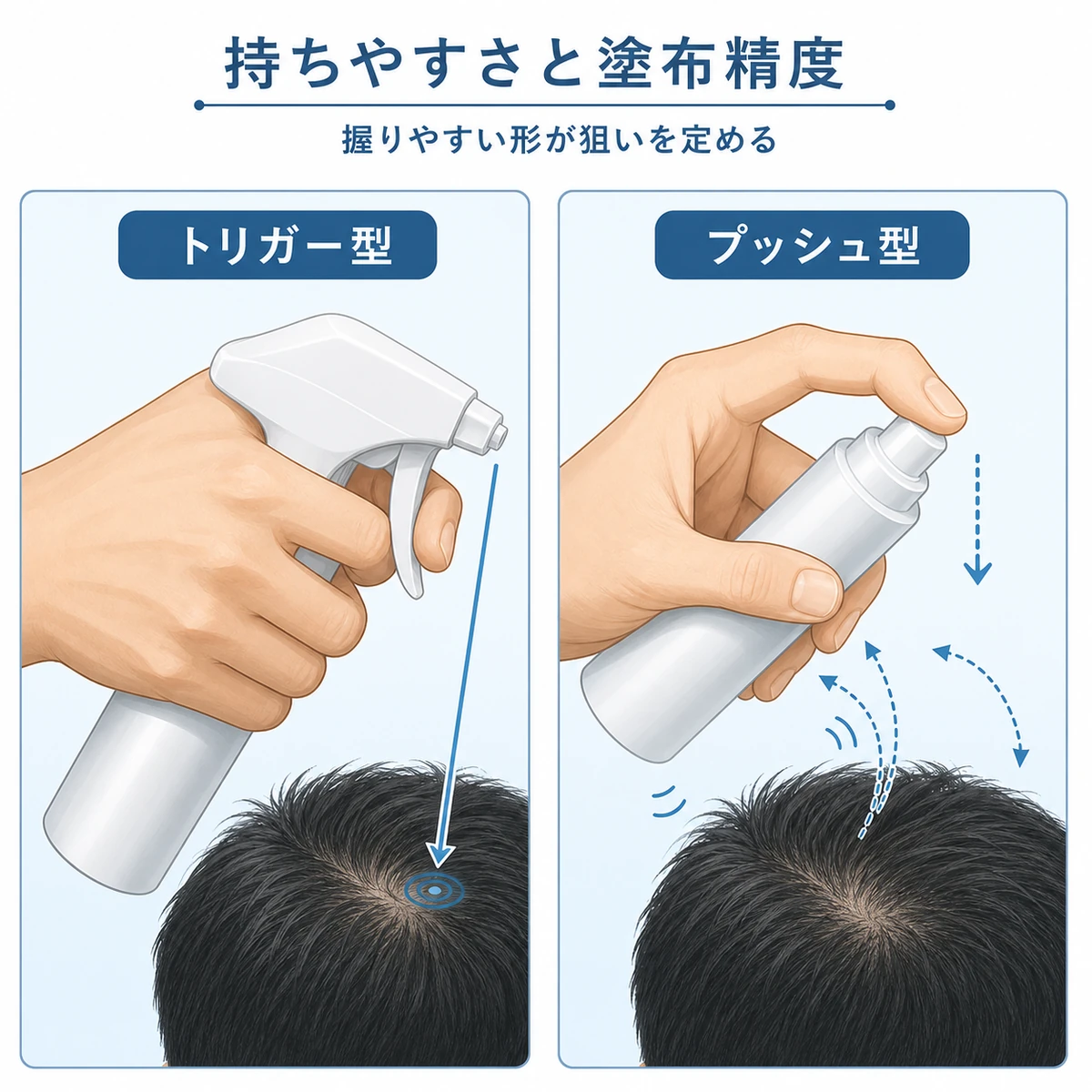 トリガー型とプッシュ型の容器を握る成人男性の手を比べ塗布の安定性を表した医療イラスト