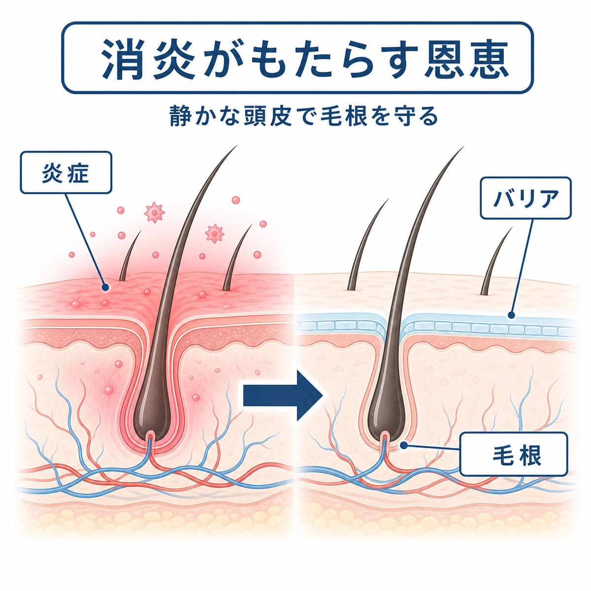 頭皮の炎症が鎮まりバリア機能が整う断面を表した医療イラスト