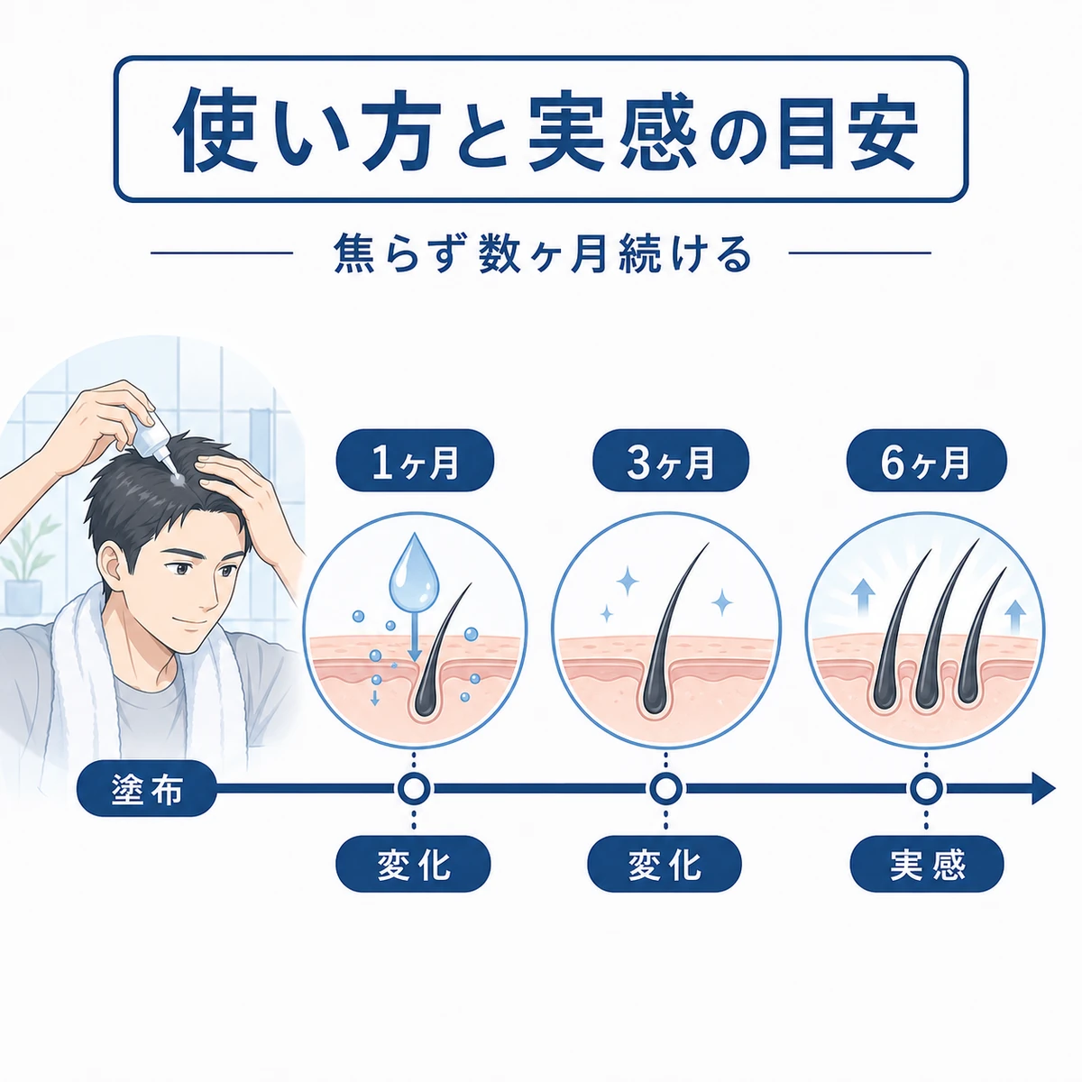 育毛剤の正しい塗布と数ヶ月の変化の目安を時系列で表した医療イラスト