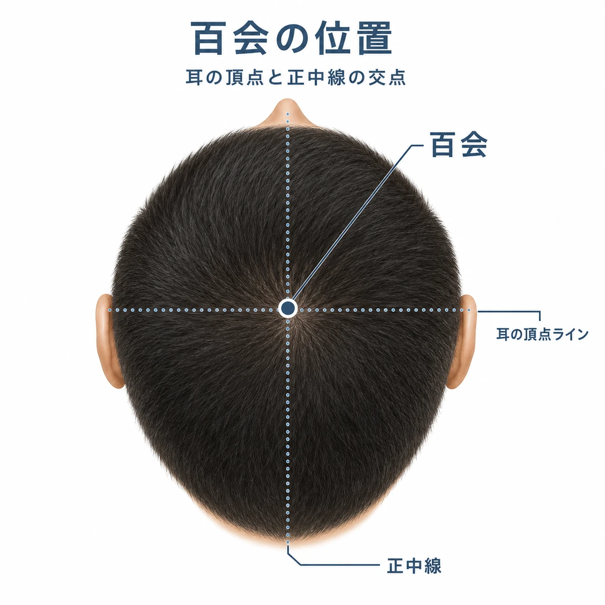 頭頂部を真上から見て百会の位置を示した頭皮ケアの解説イラスト