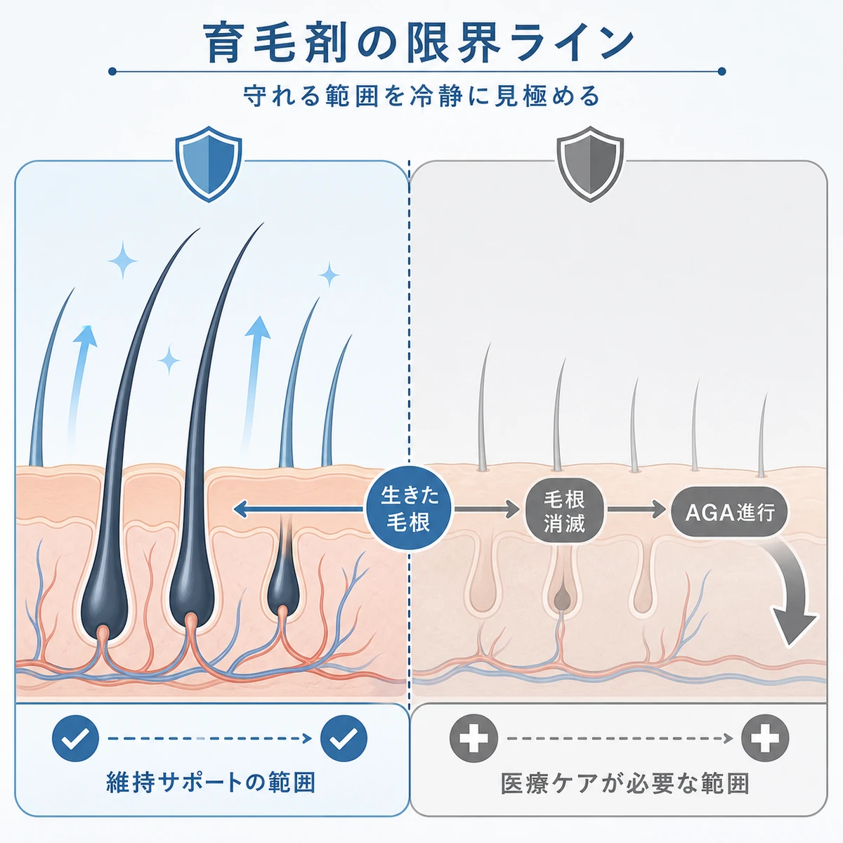 育毛剤で維持できる範囲と医療が必要な範囲を対比した医療イラスト