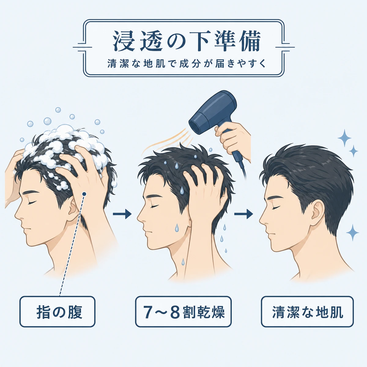 シャンプーで頭皮を洗い温風で乾かして育毛剤の下準備を整える流れを表した医療イラスト