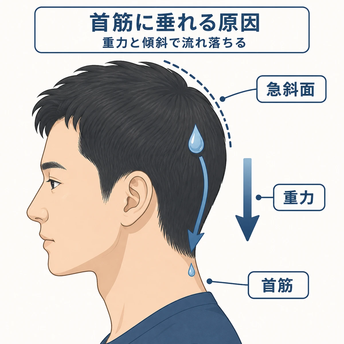頭部の急な傾斜を重力で液体が首筋へ流れ落ちる仕組みを表した医療イラスト