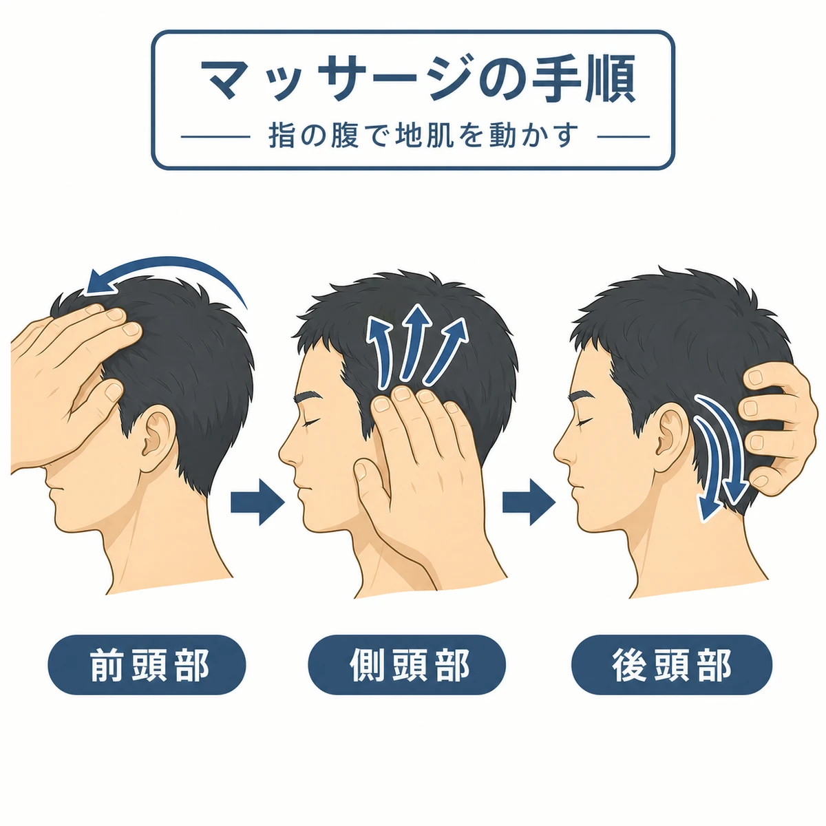 前頭部から側頭部そして後頭部へと進める頭皮マッサージの手順を示した医療イラスト