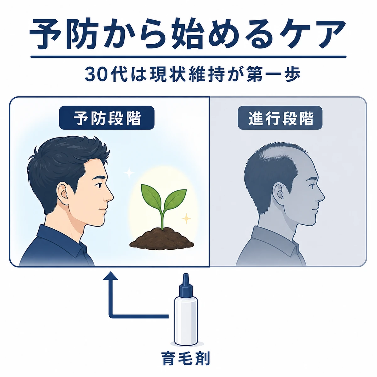 予防段階と進行段階の境界と育毛剤の役割を表した男性向け育毛の医療イラスト