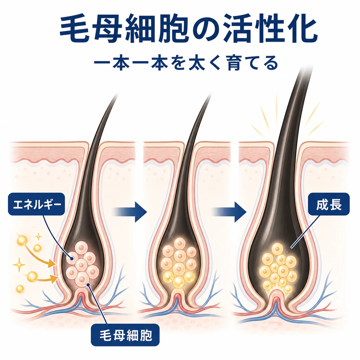 毛根内の毛母細胞が活性化して髪が太く育つ流れを表した医療イラスト