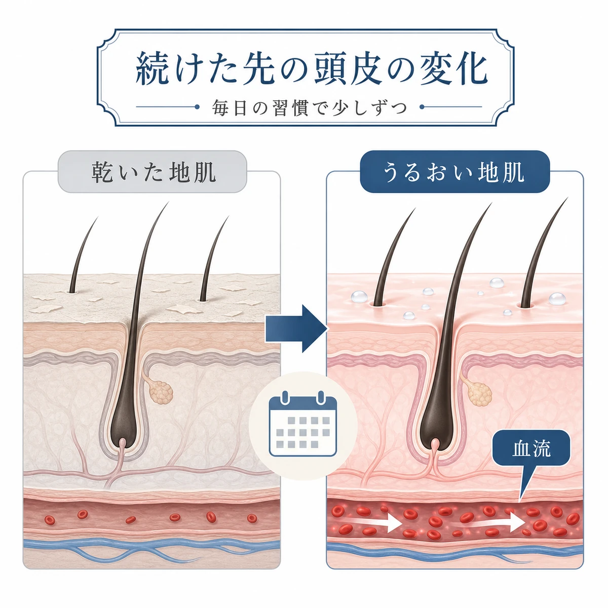 低温ケアを続けた頭皮の変化の方向性を表した医療イラスト