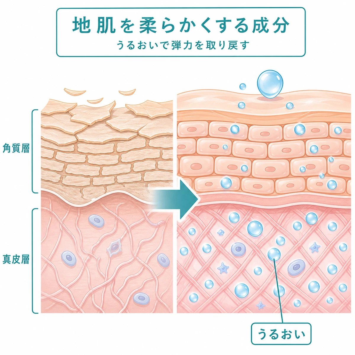 乾いた地肌が保湿成分の浸透でうるおい弾力を取り戻す層構造を表した医療イラスト