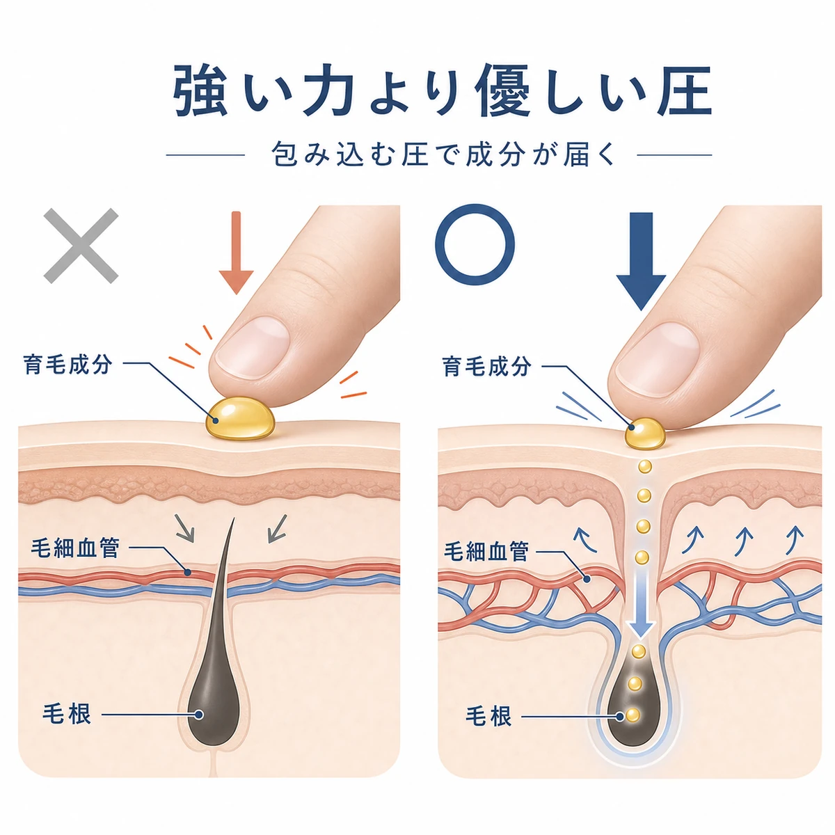 強い力と優しい圧で頭皮の毛細血管がどう変わるかを比べた断面の医療イラスト