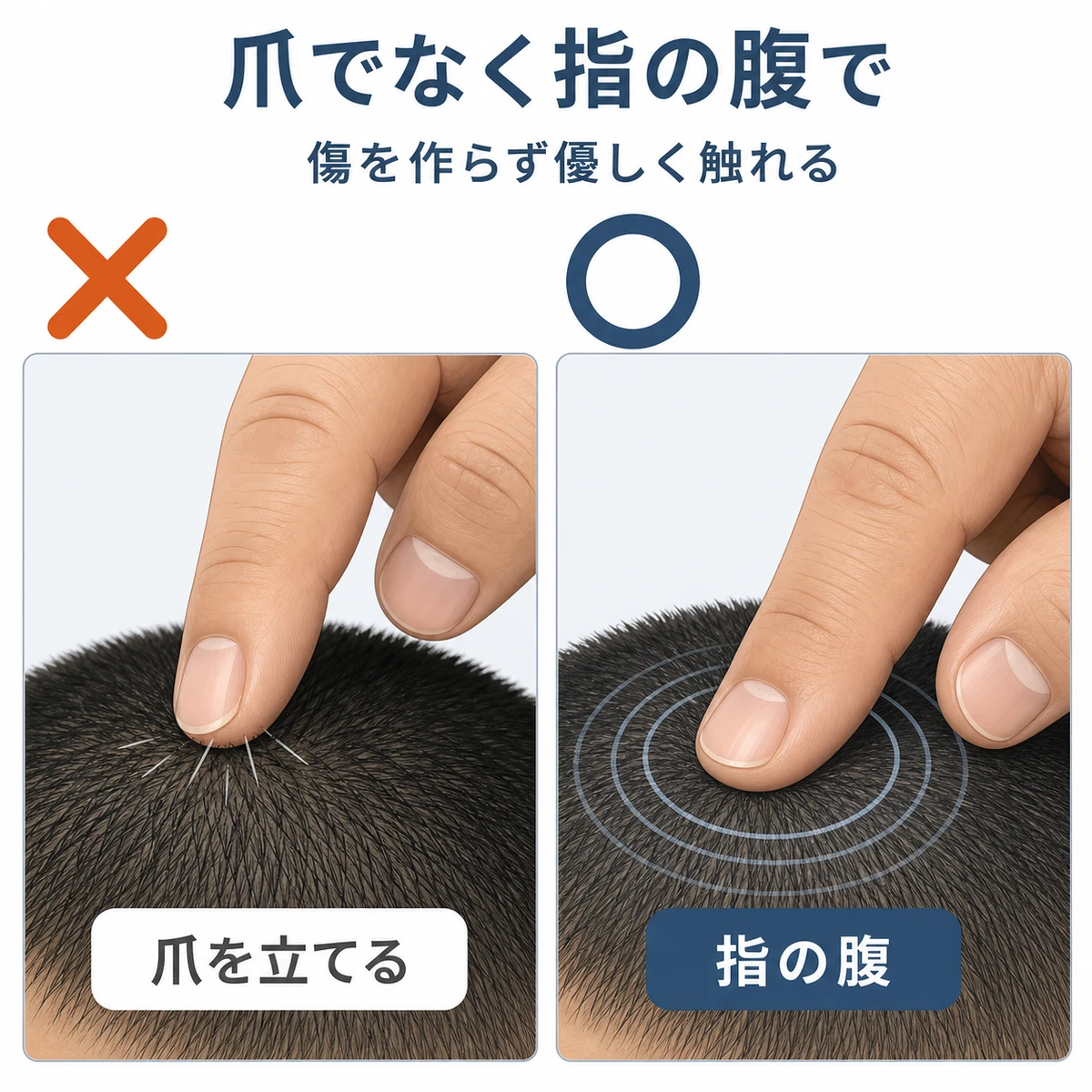 爪を立てる触れ方と指の腹で優しく触れる方法を左右で比べた頭皮ケアの医療イラスト