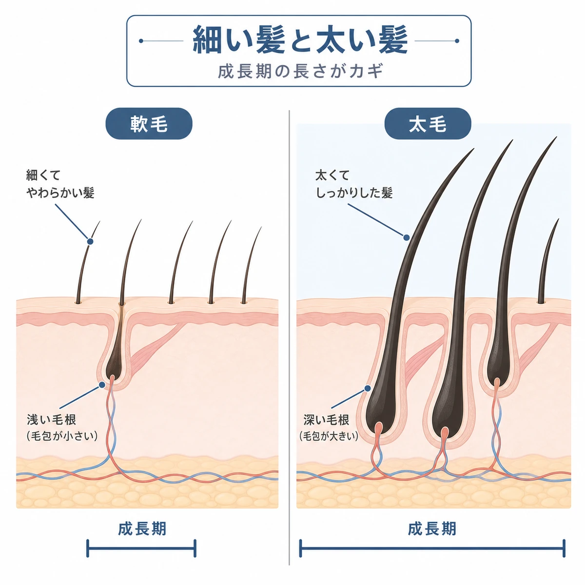 細い軟毛と太い髪の毛根の深さや成長期の長さを左右で比べた医療イラスト