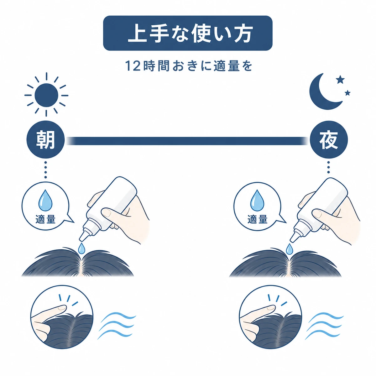 朝と夜の十二時間おきに適量の育毛剤を使う一日の実践的な使い方を帯で表した医療イラスト