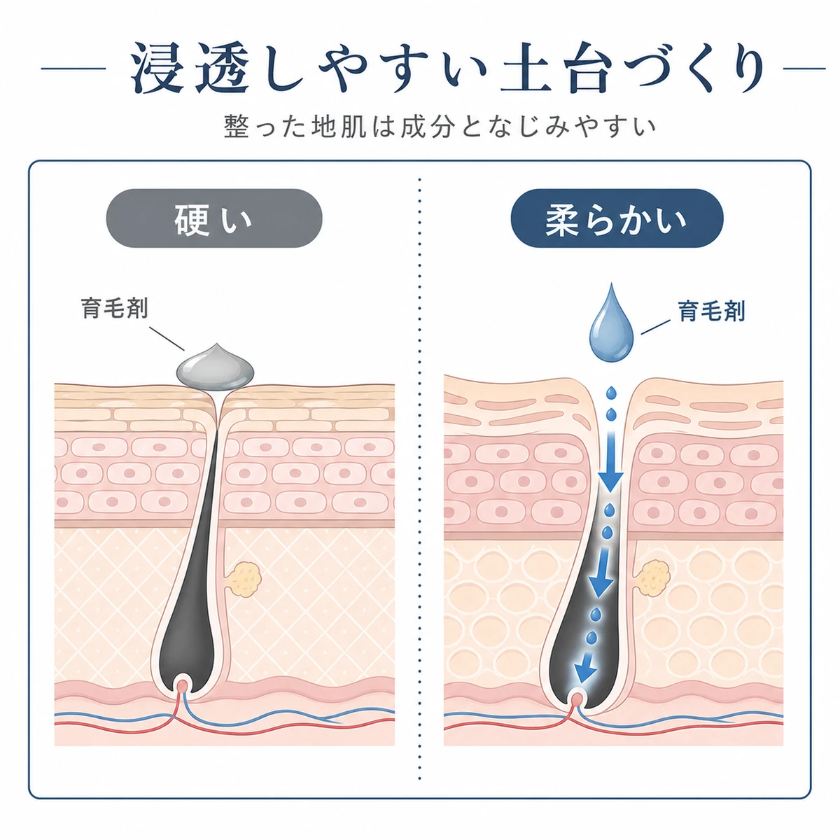 硬い地肌と柔らかい地肌で育毛剤の成分のなじみ方が変わる様子を左右で対比した医療イラスト