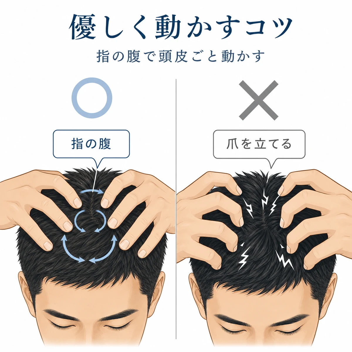 指の腹で優しく動かす良い例と爪を立てる悪い例を対比した育毛イラスト
